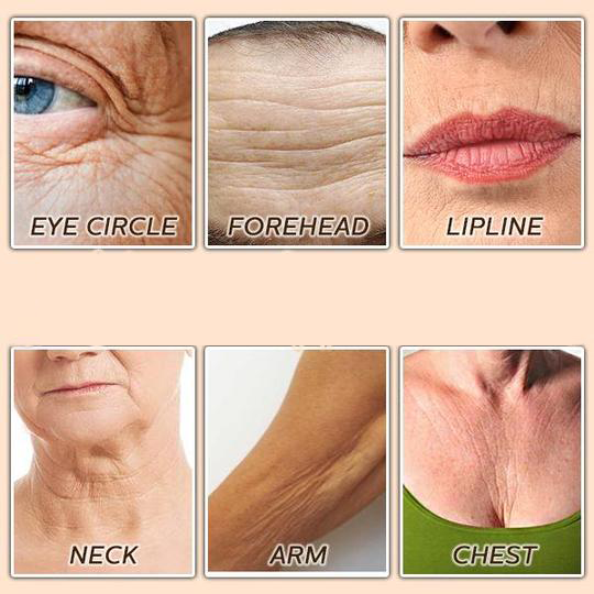 BBOJI™ Turmeric Milk Face Serum – Anti-Aging & Skin Brightening with Hyaluronic Acid, Niacinamide & Milk Extract