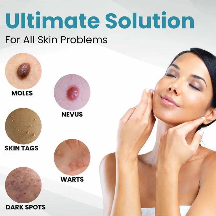 🔥【OFFICIAL STORE】LOVILDS™ Non-Invasive Mole and Wart Removal Laser Pen