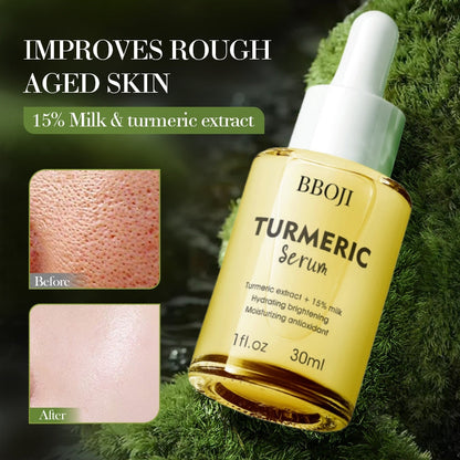 BBOJI™ Turmeric Milk Face Serum – Anti-Aging & Skin Brightening with Hyaluronic Acid, Niacinamide & Milk Extract