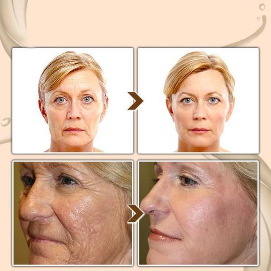 BBOJI™ Turmeric Milk Face Serum – Anti-Aging & Skin Brightening with Hyaluronic Acid, Niacinamide & Milk Extract