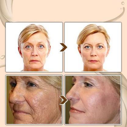 BBOJI™ Turmeric Milk Face Serum – Anti-Aging & Skin Brightening with Hyaluronic Acid, Niacinamide & Milk Extract