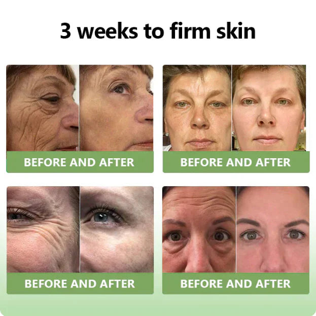 ✨️Advanced Formula 2.0🌿(🔥LAST DAY SALE-80% OFF) HZA™ Luxurious Collagen Firming Cream Pro