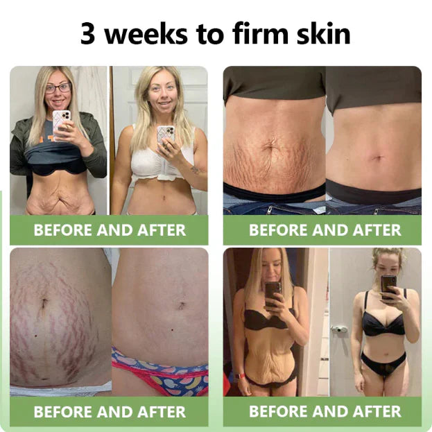 ✨️Advanced Formula 2.0🌿(🔥LAST DAY SALE-80% OFF) HZA™ Luxurious Collagen Firming Cream Pro