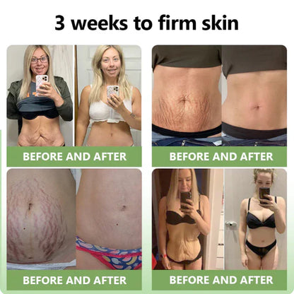 ✨️Advanced Formula 2.0🌿(🔥LAST DAY SALE-80% OFF) HZA™ Luxurious Collagen Firming Cream Pro