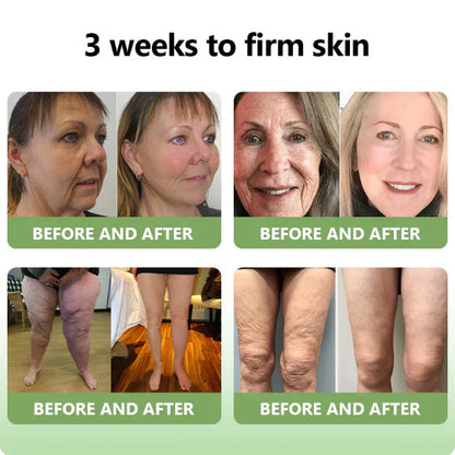 ✨️Advanced Formula 2.0🌿(🔥LAST DAY SALE-80% OFF) HZA™ Luxurious Collagen Firming Cream Pro