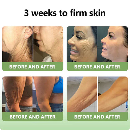 ✨️Advanced Formula 2.0🌿(🔥LAST DAY SALE-80% OFF) HZA™ Luxurious Collagen Firming Cream Pro