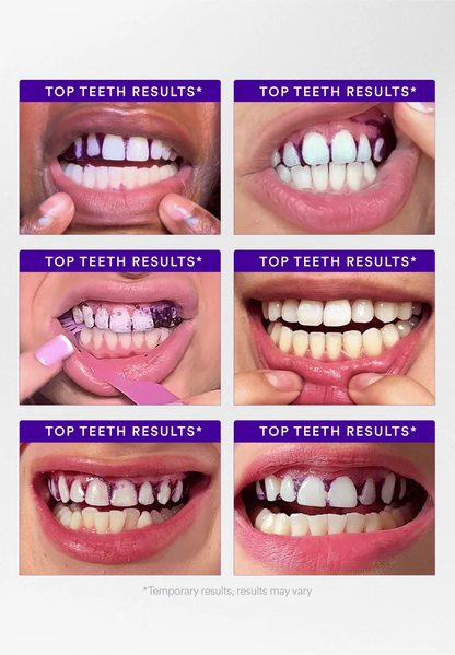 👨‍⚕️Purple Teeth Whitening Strips:Revolutionary Dissolving Diamond Series Technology with Hydroxyapatite 💎